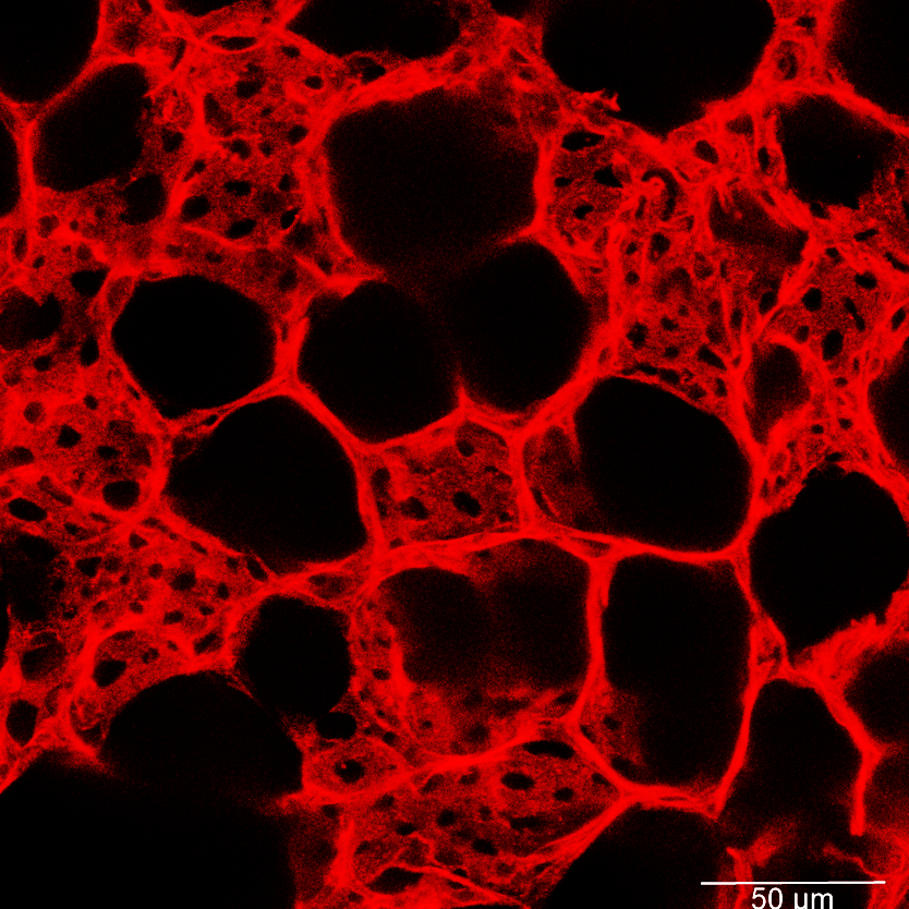 Confocal imaging demonstrating the dense network of capillary blood vessels in the lung.